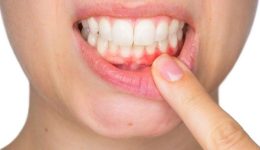 Diş ve Diş Eti Hassasiyeti Nedir?